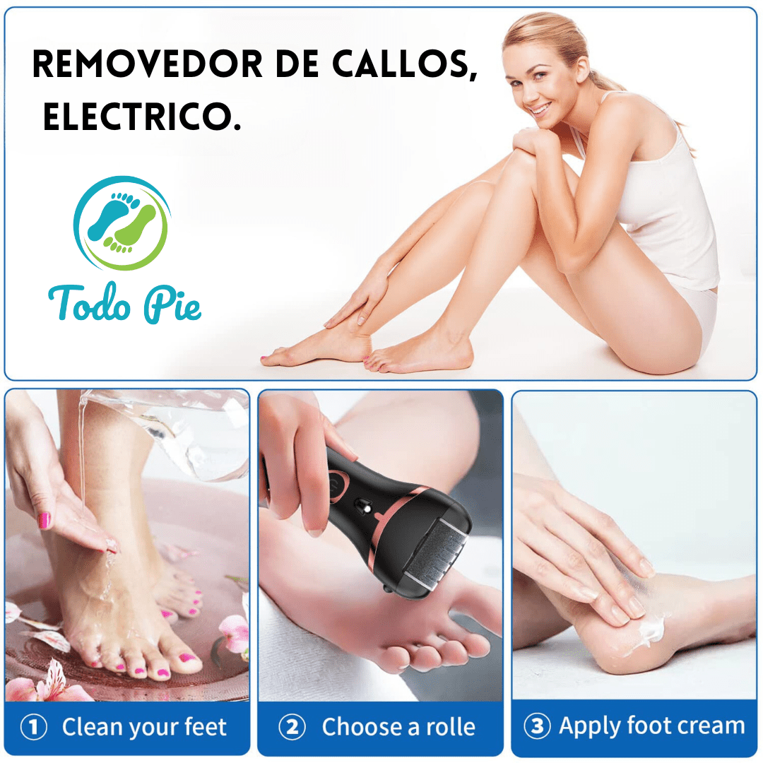 Removedor eléctrico de callos - TodoPie
